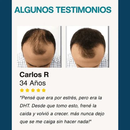 DHT Blocker Fórmula para cabello y piel Simply Revival (60 Cápsulas)