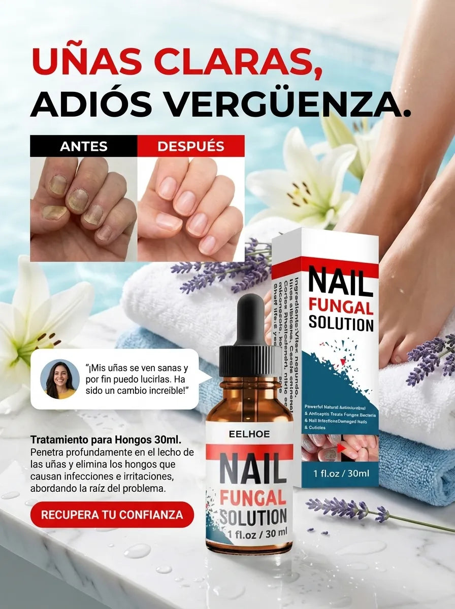 Nail Fungal – Gotas Antihongos Avanzado para Uñas (30 ml)