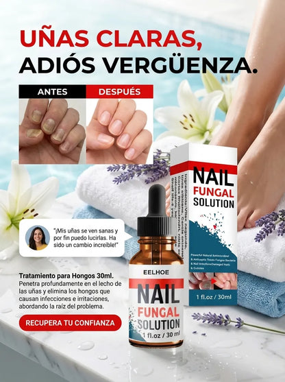 Nail Fungal – Gotas Antihongos Avanzado para Uñas (30 ml)