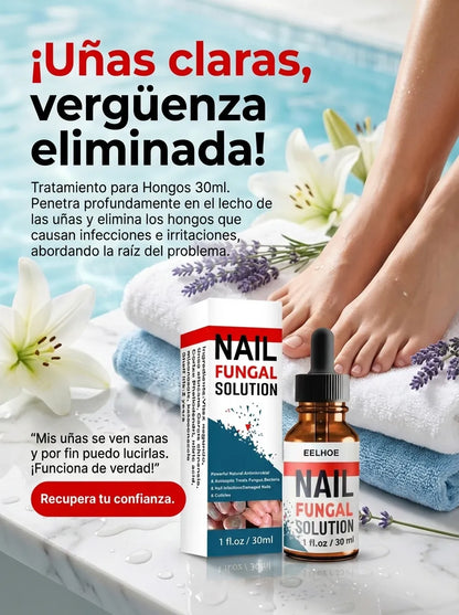 Nail Fungal – Gotas Antihongos Avanzado para Uñas (30 ml)