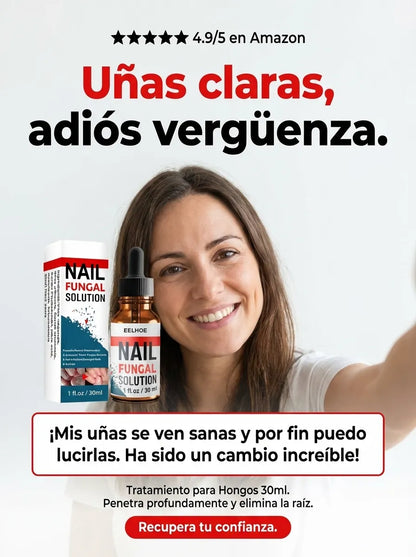 Nail Fungal – Gotas Antihongos Avanzado para Uñas (30 ml)