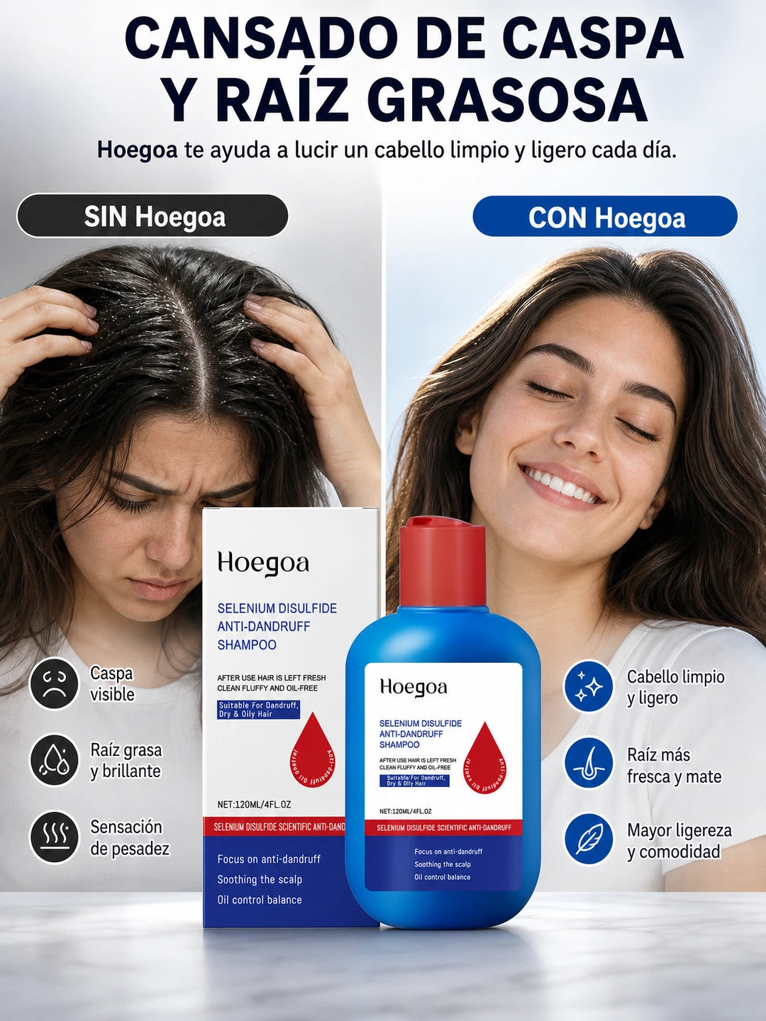 SELENIUM DISULFIDE ANTI-DANDRUFF SHAMPOO – Champú Anticaspa con Disulfuro de Selenio para Control de Caspa, Grasa y Cuidado del Cuero Cabelludo (120 ml)