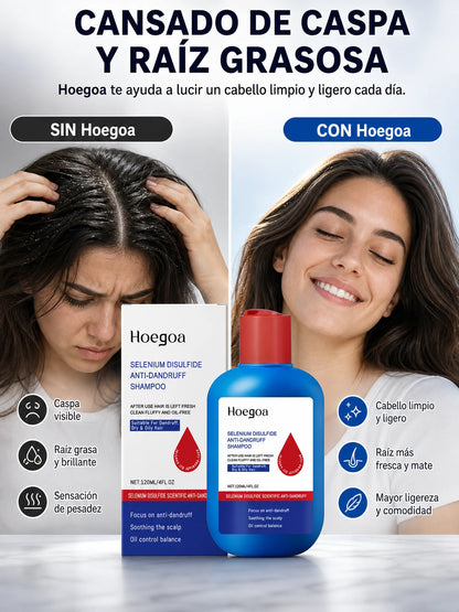 SELENIUM DISULFIDE ANTI-DANDRUFF SHAMPOO – Champú Anticaspa con Disulfuro de Selenio para Control de Caspa, Grasa y Cuidado del Cuero Cabelludo (120 ml)