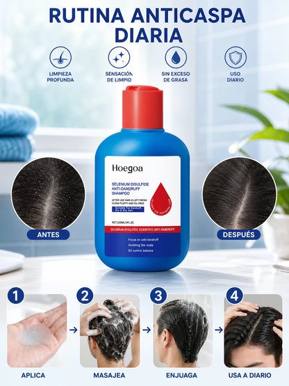 SELENIUM DISULFIDE ANTI-DANDRUFF SHAMPOO – Champú Anticaspa con Disulfuro de Selenio para Control de Caspa, Grasa y Cuidado del Cuero Cabelludo (120 ml)