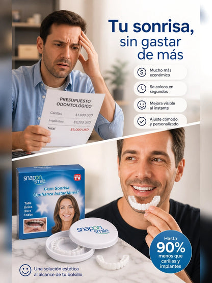 Snap Smile – Carillas Dentales Removibles para una Sonrisa Más Uniforme